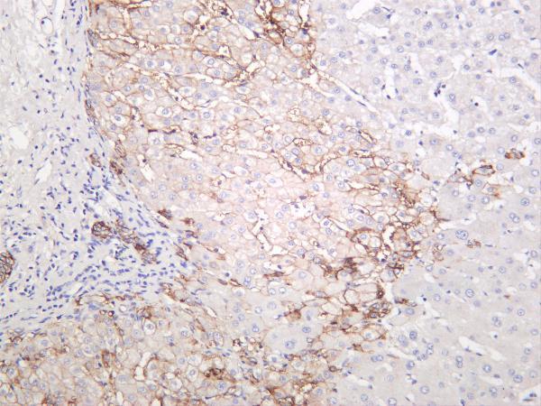Human liver was stained with anti-EpCAM rabbit antibody