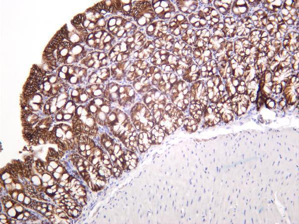 Mouse colon was stained with anti-EpCAM rabbit antibody