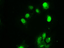 m00277 1 anti chk2 chek2 mouse monoclonal antibody clone id oti5c4 if testing 11