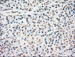 m00277 1 anti chk2 chek2 mouse monoclonal antibody clone id oti5c4 ihc testing 4