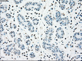 m00277 1 anti chk2 chek2 mouse monoclonal antibody clone id oti5c4 ihc testing 5