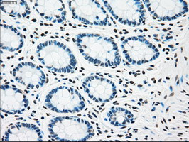 m00277 1 anti chk2 chek2 mouse monoclonal antibody clone id oti5c4 ihc testing 6