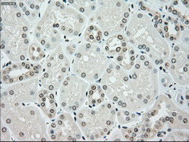 m00277 1 anti chk2 chek2 mouse monoclonal antibody clone id oti5c4 ihc testing 7