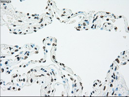 m00277 1 anti chk2 chek2 mouse monoclonal antibody clone id oti5c4 ihc testing 9