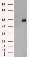 m00277 1 anti chk2 chek2 mouse monoclonal antibody clone id oti5c4 wb testing 1
