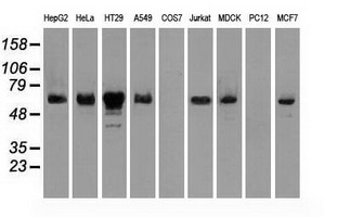 m00277 1 anti chk2 chek2 mouse monoclonal antibody clone id oti5c4 wb testing 2