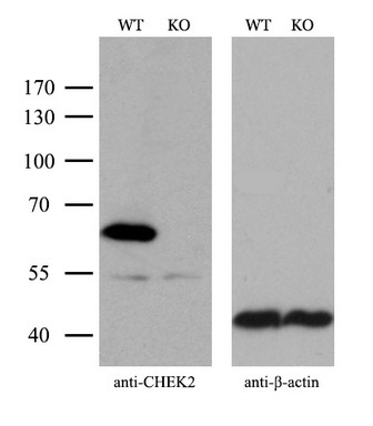 m00277 1 anti chk2 chek2 mouse monoclonal antibody clone id oti5c4 wb testing 3
