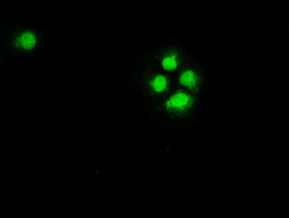 m00277 2 anti chk2 chek2 mouse monoclonal antibody clone id oti2f4 if testing 7