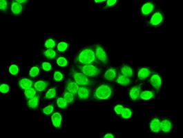 m00277 2 anti chk2 chek2 mouse monoclonal antibody clone id oti2f4 if testing 8