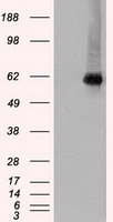 HEK293T cells were transfected with the pCMV6-ENTRY control (Left lane) or pCMV6-ENTRY CHEK2 (Right lane) cDNA for 48 hrs and lysed