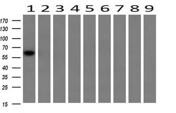 Western blot analysis of extracts (10ug) from 9 Human tissue by using anti-CHEK2 monoclonal antibody at 1:200 (1: Testis; 2: Omentum; 3: Uterus; 4: Breast; 5: Brain; 6: Liver; 7: Ovary; 8: Thyroid gland; 9: Colon)