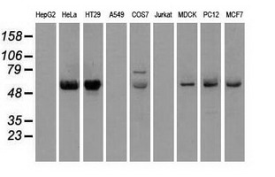 Western blot analysis of extracts (35ug) from 9 different cell lines by using anti-CHEK2 monoclonal antibody