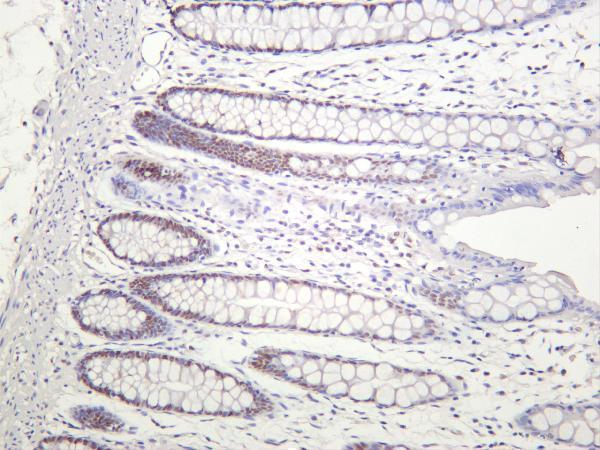 Human colon was stained with anti-Chk2 rabbit antibody