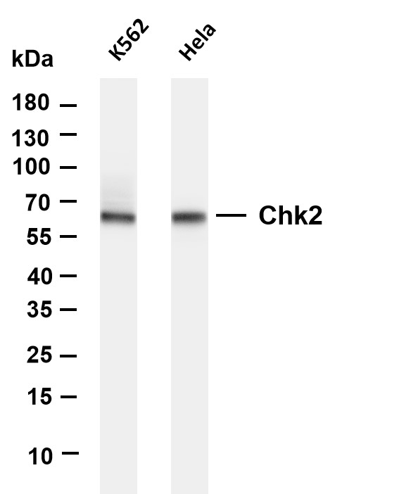 Various whole cell lysates were separated by 4-20% SDS-PAGE, and the membrane was blotted with anti-Chk2 antibody