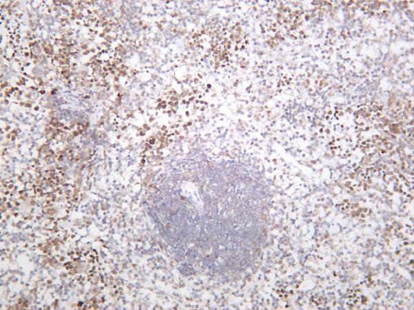 Mouse spleen was stained with anti-Chk2 rabbit antibody