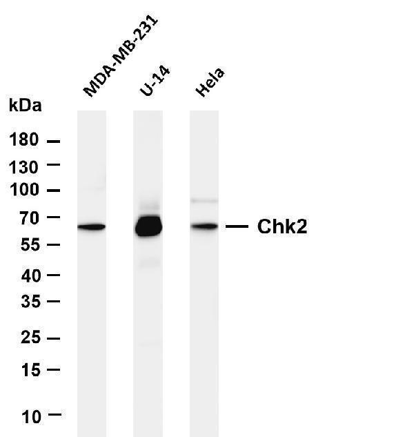 Various whole cell lysates were separated by 4-20% SDS-PAGE, and the membrane was blotted with anti-Chk2 antibody
