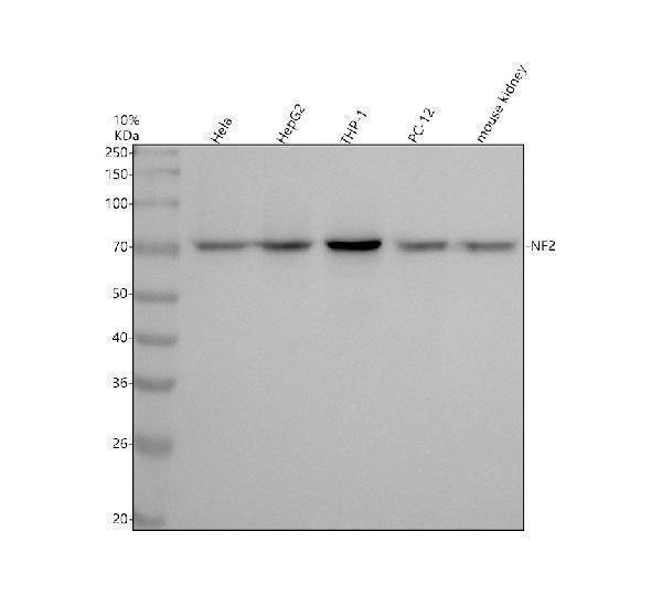 m00279 nf2 primary antibodies wb testing 1