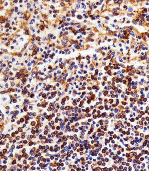 Immunohistochemical analysis of paraffin-embedded H
