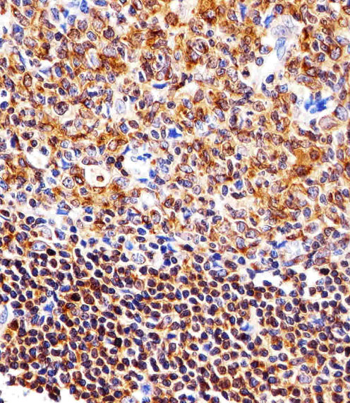 Immunohistochemical analysis of paraffin-embedded H
