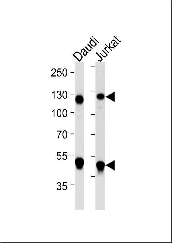 Western blot analysis of lysates from Daudi, Jurkat cell line (from left to right), using NFKB1 Antibody