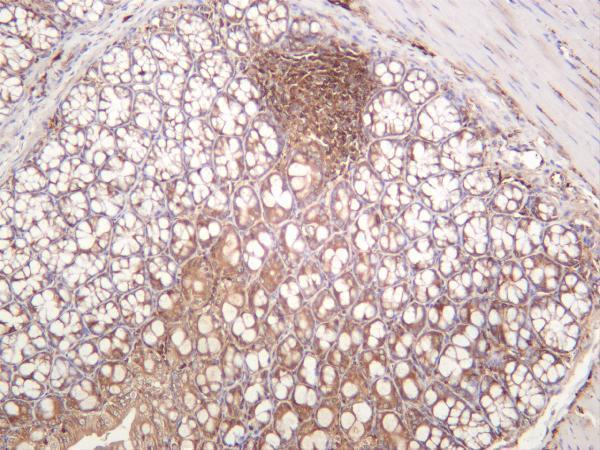 Mouse colon was stained with anti-NF-κB p65 rabbit antibody