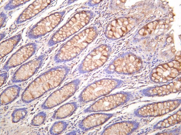 Human colon was stained with anti-NF-κB p65 rabbit antibody