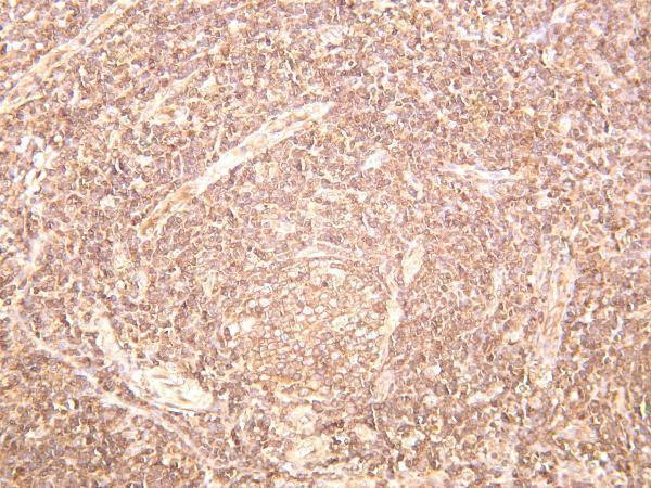 Human tonsil was stained with anti-NF-κB p65 rabbit antibody