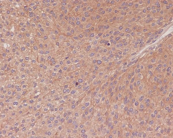 m00284 ihc