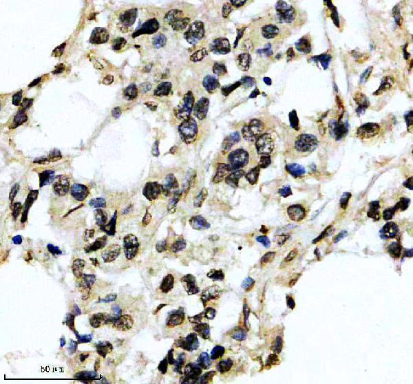 IHC analysis of MMP2 using anti-MMP2 antibody (M00286-1)