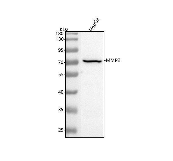  Western blot analysis of MMP2 using anti-MMP2 antibody (M00286-1)