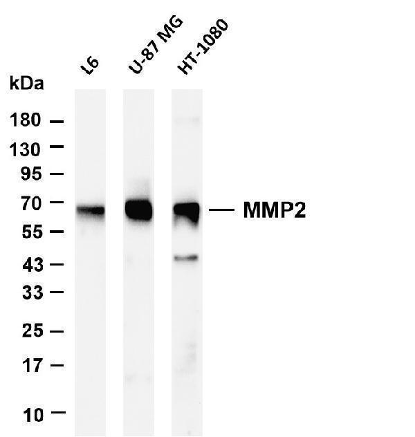Various whole cell lysates were separated by 4-20% SDS-PAGE, and the membrane was blotted with anti-MMP2 antibody