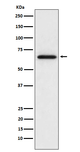 Western blot analysis of MMP2 expression in L6 cell lysate