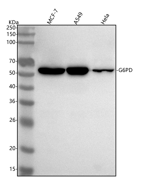  Western blot analysis of G6PD using anti-G6PD antibody (M00287)