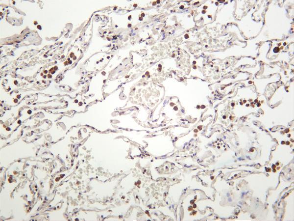 Human lung was stained with anti-MEK1 rabbit antibody