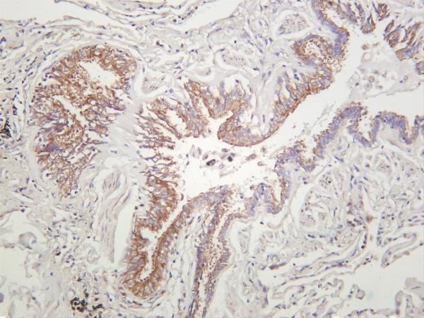 m00292 6 map2k1 primary antibodies ihc testing 1