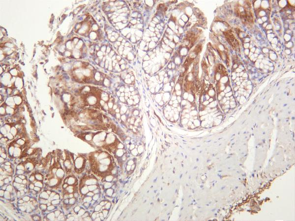 m00292 6 map2k1 primary antibodies ihc testing 2