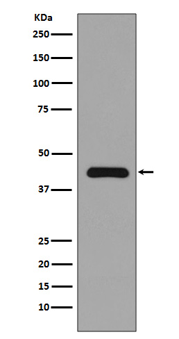 Anti-MEK1 MAP2K1 Rabbit Monoclonal Antibody Anti-MEK1 MAP2K1 Rabbit Monoclonal Antibody