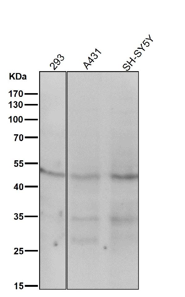 Western blot analysis of MEK1 expression in A431 cell lysate. Western blot analysis of MEK1 expression in A431 cell lysate.
