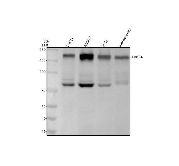 Western blot analysis of ERBB4 using anti-ERBB4 antibody (M00296)