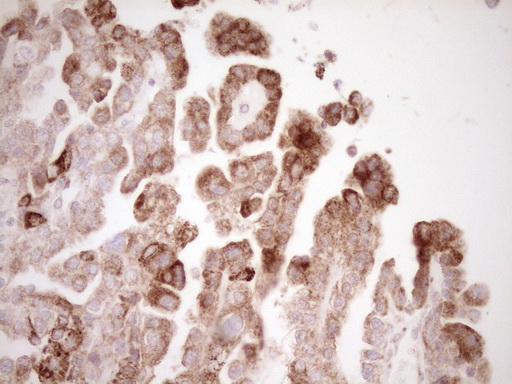 m00299 anti vip mouse monoclonal antibody clone id oti1e8 ihc testing 2