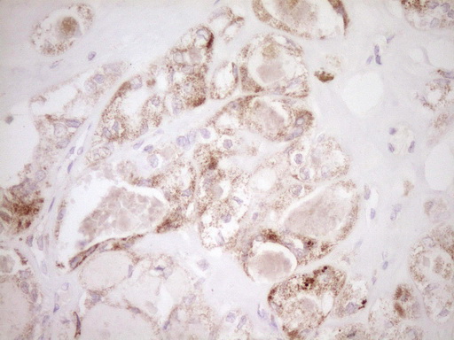 m00299 anti vip mouse monoclonal antibody clone id oti1e8 ihc testing 3