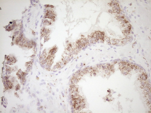 m00299 anti vip mouse monoclonal antibody clone id oti1e8 ihc testing 4