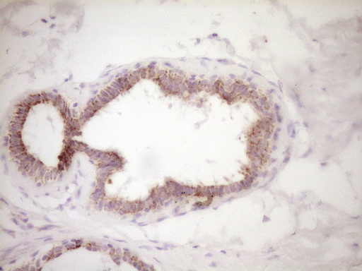 m00299 anti vip mouse monoclonal antibody clone id oti1e8 ihc testing 5