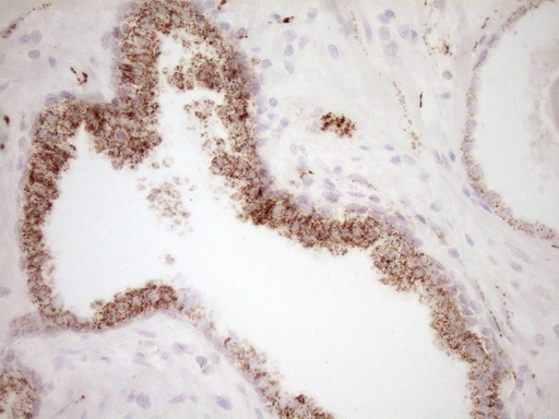 m00299 anti vip mouse monoclonal antibody clone id oti1e8 ihc testing 6