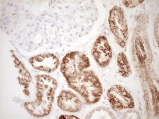 m00299 anti vip mouse monoclonal antibody clone id oti1e8 ihc testing 7