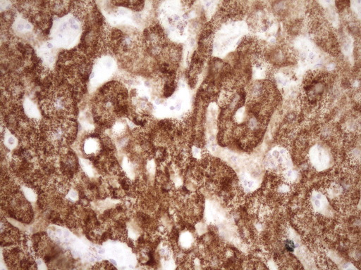m00299 anti vip mouse monoclonal antibody clone id oti1e8 ihc testing 8
