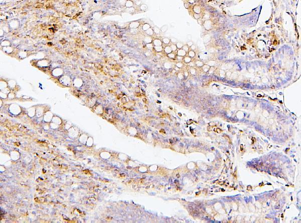 m00300 1 sqstm1 primary antibodies ihc testing 2