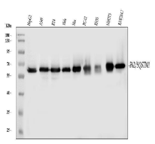 m00300 1 sqstm1 primary antibodies wb testing 1
