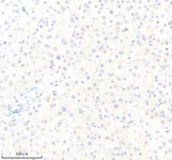 m00300 3 sqstm1 primary antibodies ihc testing 2
