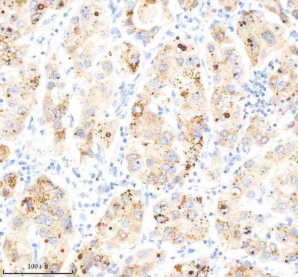 m00300 3 sqstm1 primary antibodies ihc testing 3